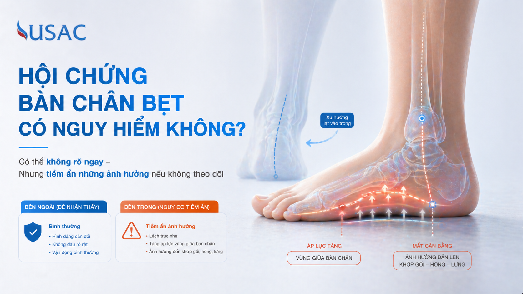 Hội Chứng Bàn Chân Bẹt Có Nguy Hiểm Không Hội Chứng Bàn Chân Bẹt Có Nguy Hiểm Không