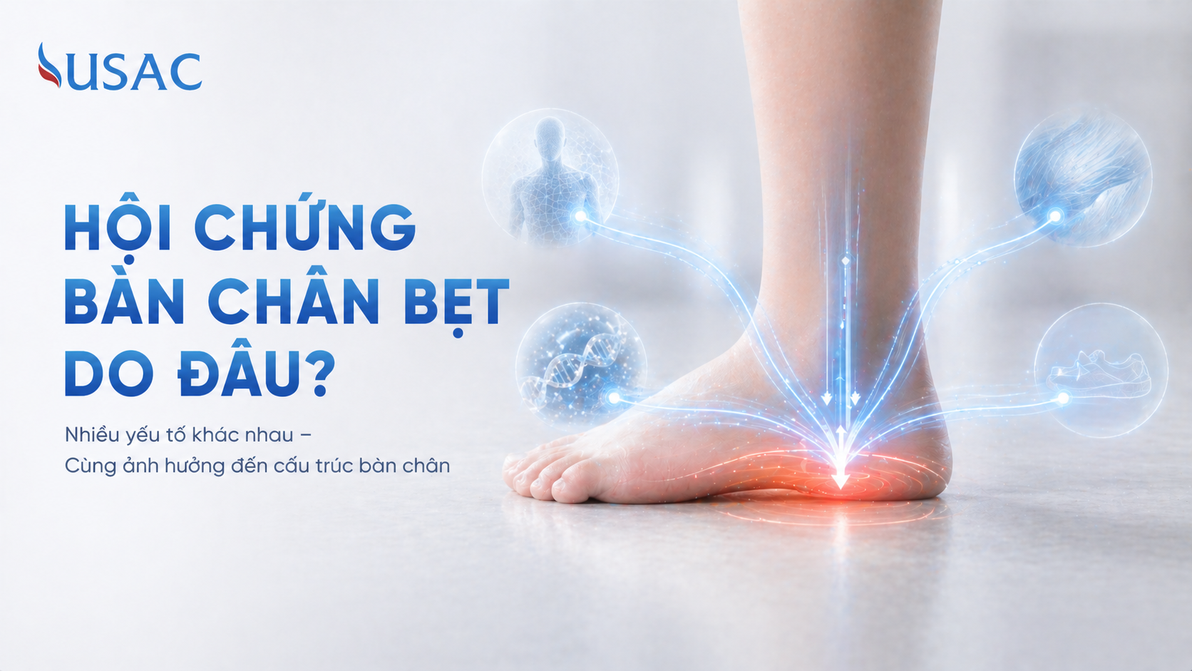 Hội Chứng Bàn Chân Bẹt Do Đâu