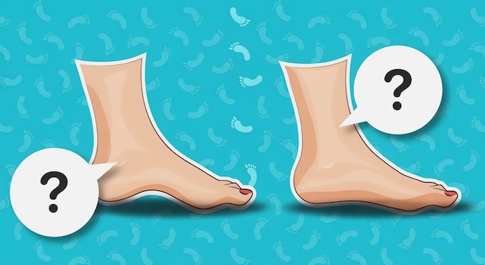 Lòng Bàn Chân Bằng Phẳng