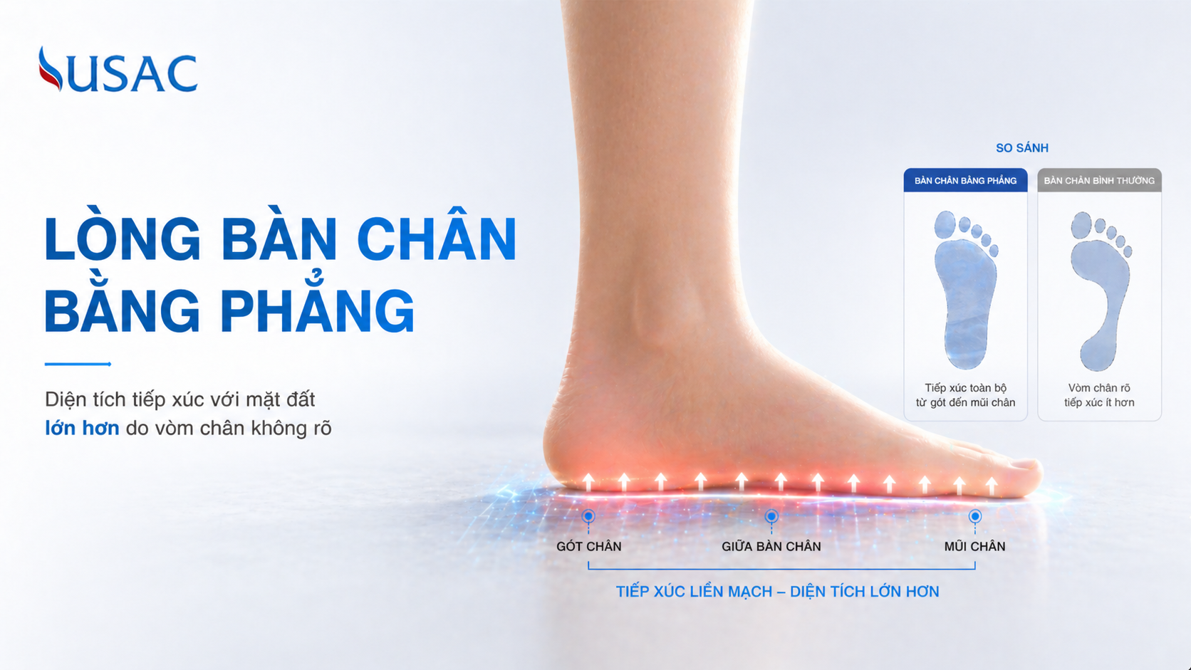 Lòng Bàn Chân Bằng Phẳng