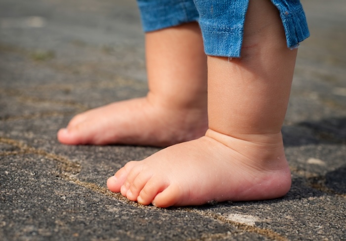 Lòng Bàn Chân Phẳng Có Tốt Không