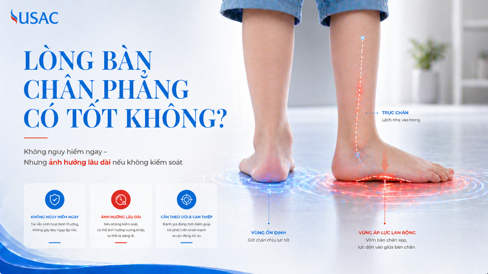 Lòng Bàn Chân Phẳng Có Tốt Không