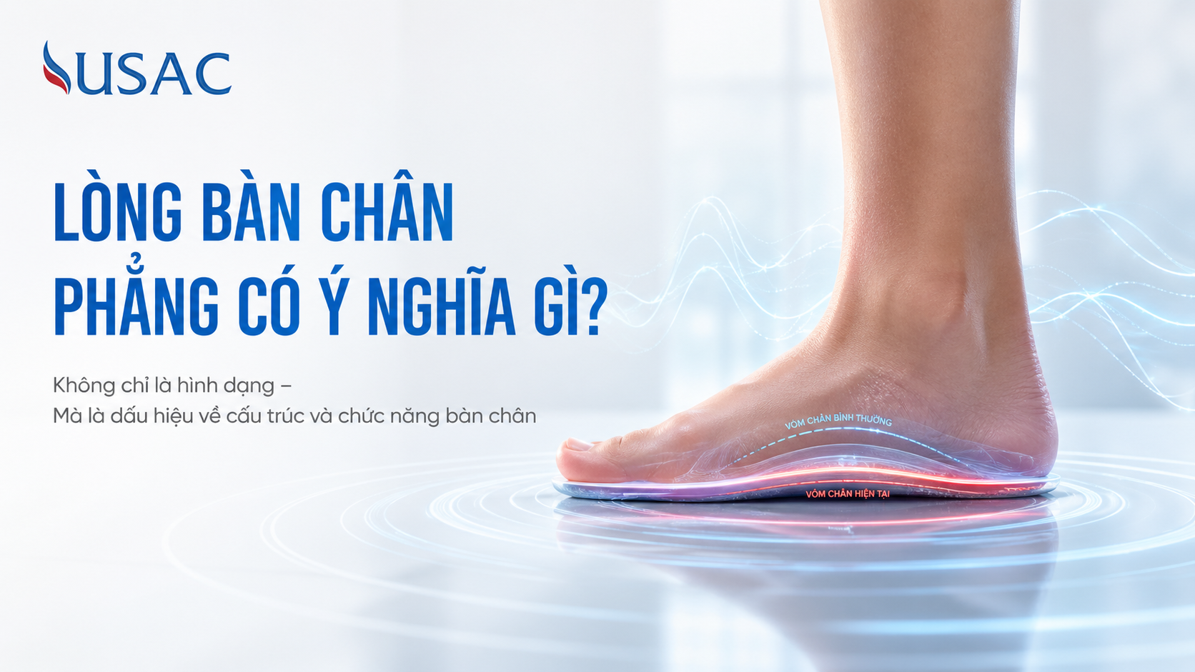 Lòng Bàn Chân Phẳng Có Ý Nghĩa Gì Lòng Bàn Chân Phẳng Có Ý Nghĩa Gì