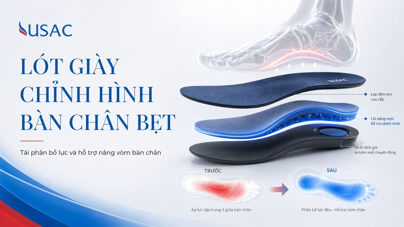 Lót giày chỉnh hình bàn chân bẹt