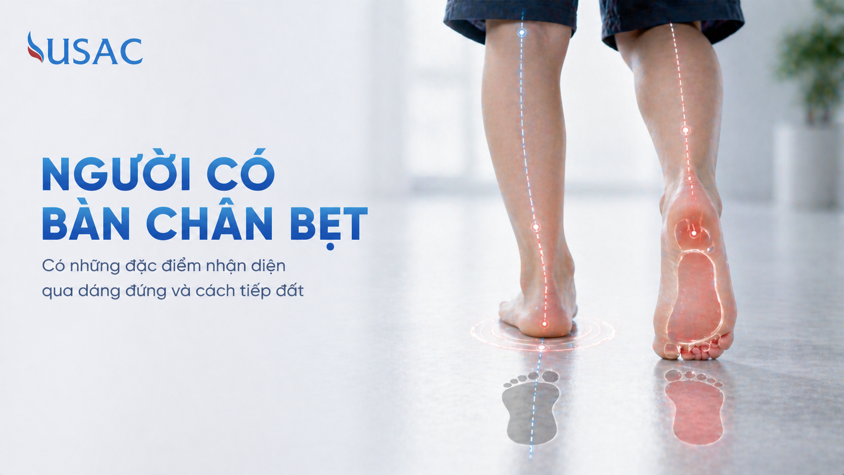 Người Có Bàn Chân Bẹt