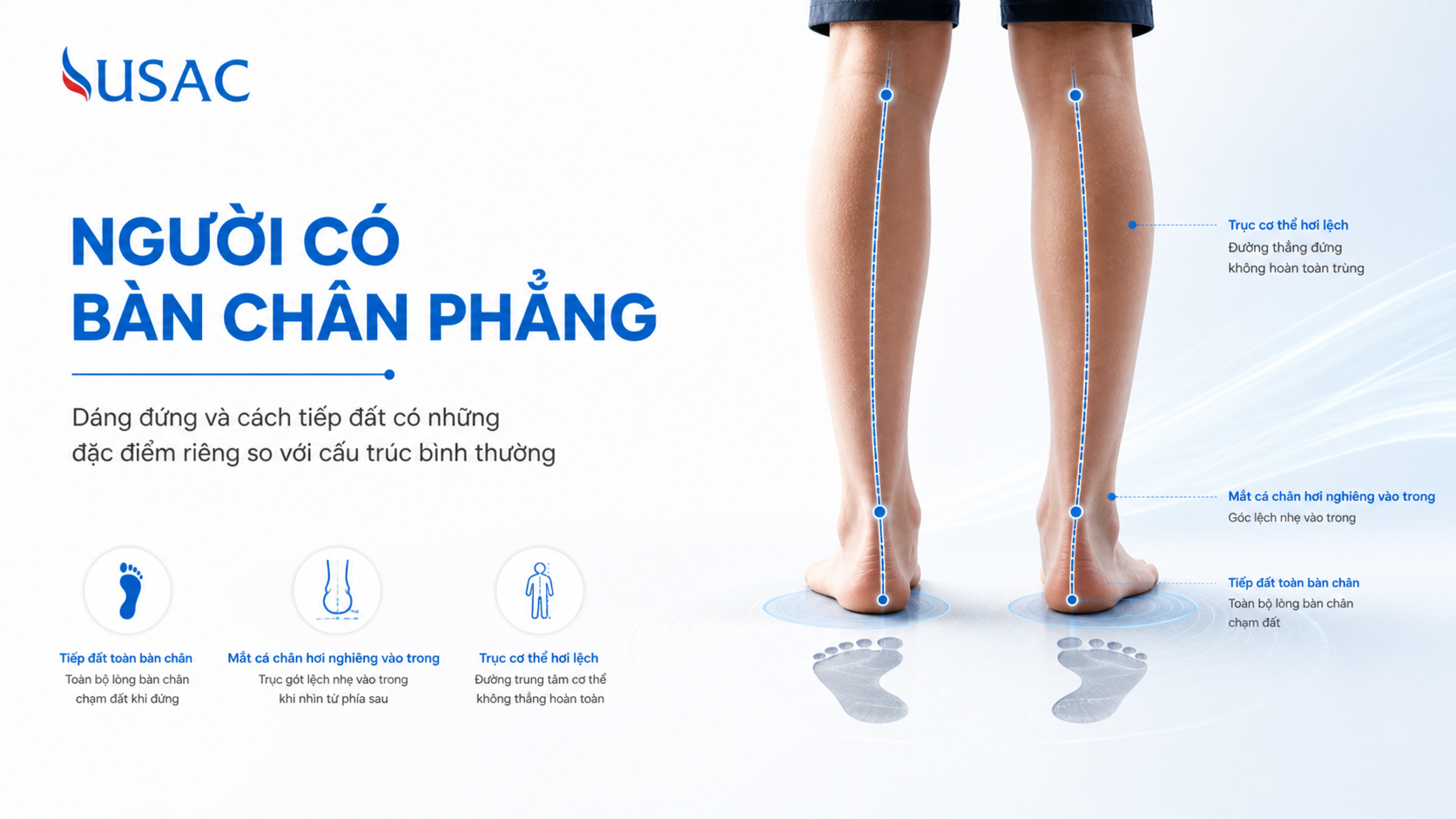 Người Có Bàn Chân Phẳng Người Có Bàn Chân Phẳng