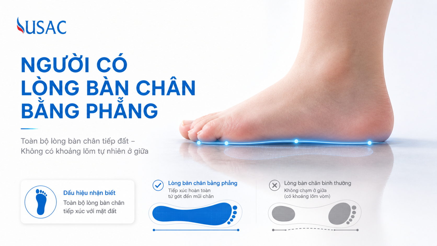 Người Có Lòng Bàn Chân Bằng Phẳng Người Có Lòng Bàn Chân Bằng Phẳng