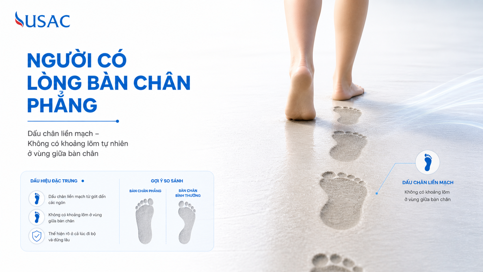 Người Có Lòng Bàn Chân Phẳng Người Có Lòng Bàn Chân Phẳng