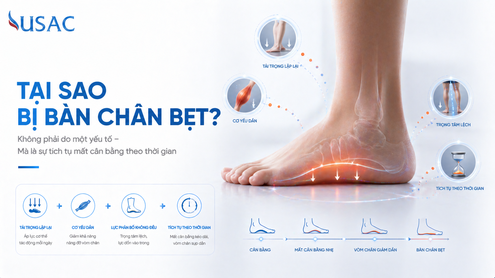 Tại Sao Bị Bàn Chân Bẹt