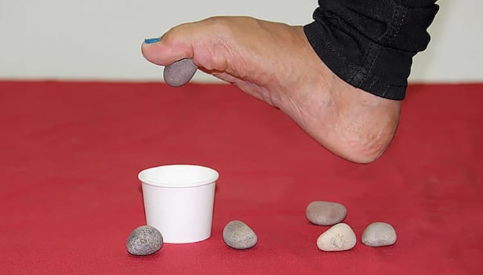 Tập Bàn Chân Bẹt