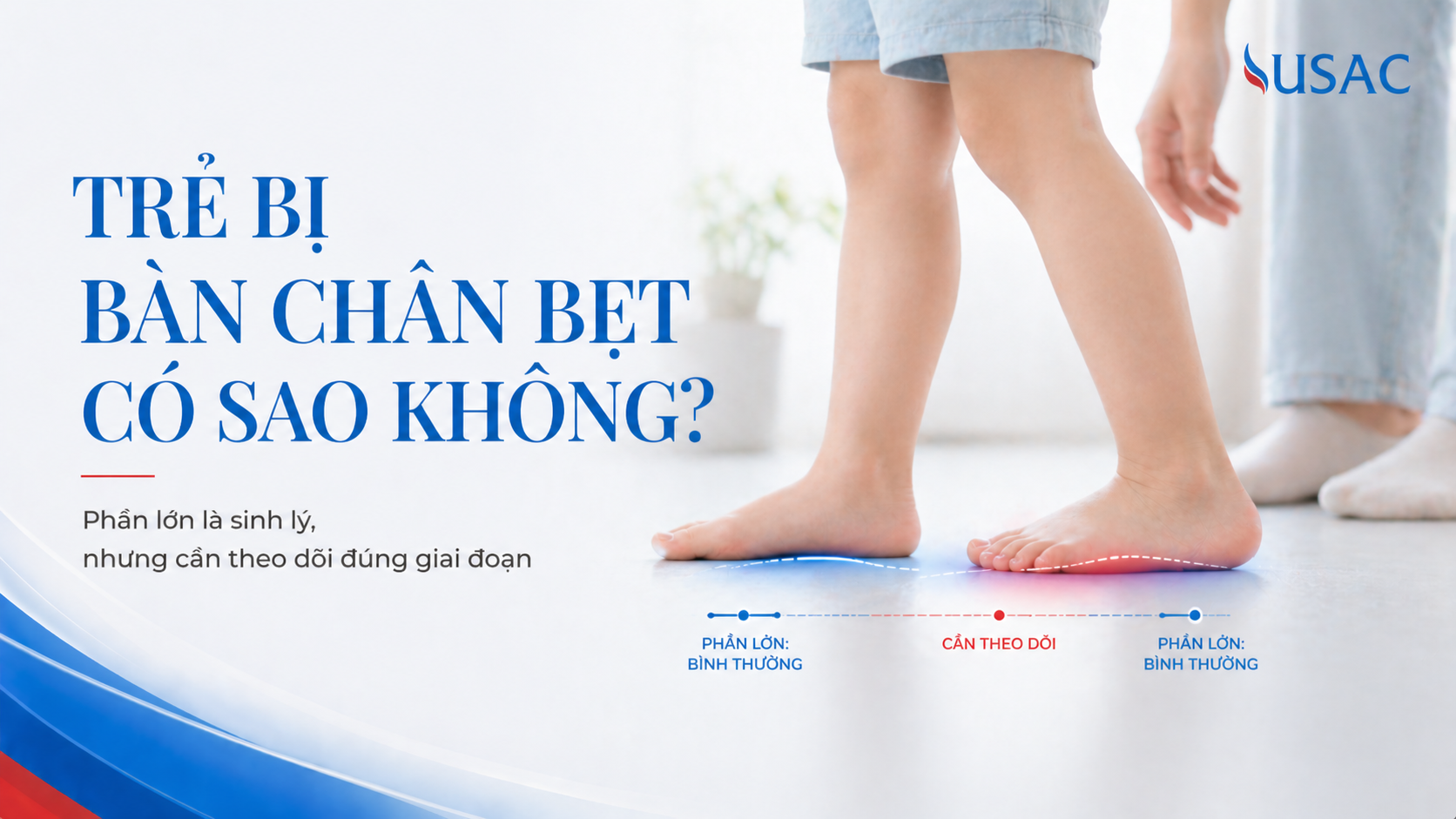 Trẻ Bị Bàn Chân Bẹt Có Sao Không