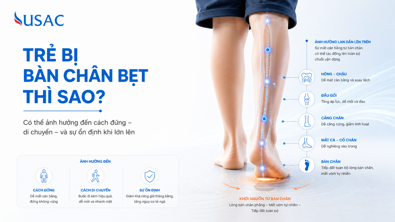 Trẻ Bị Bàn Chân Bẹt Thì Sao
