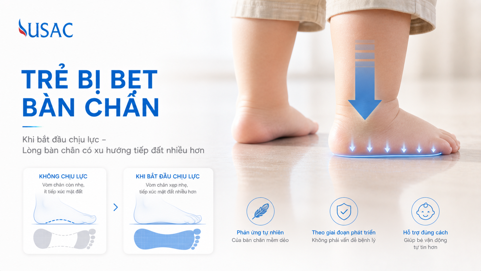 Trẻ Bị Bẹt Bàn Chân