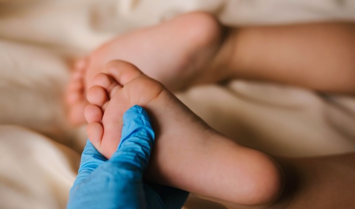 Trẻ Con Bị Bàn Chân Bẹt