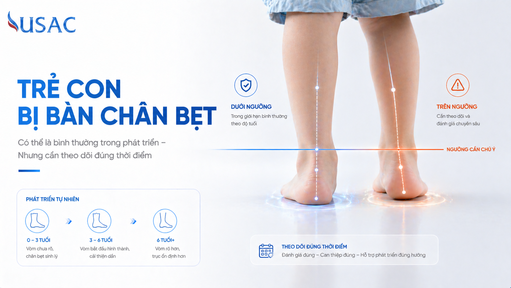 Trẻ Con Bị Bàn Chân Bẹt