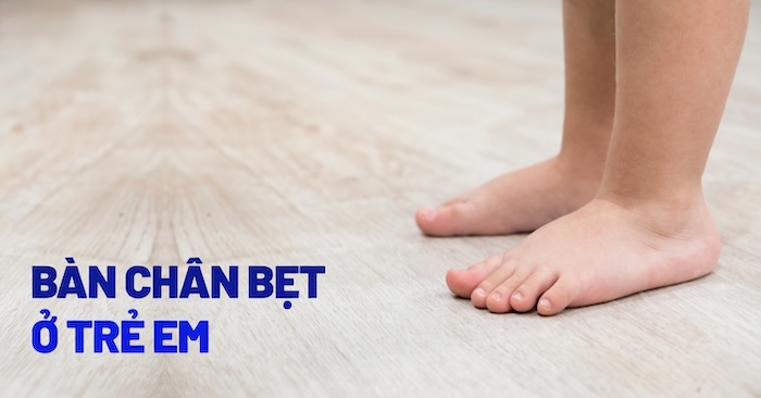 Triệu Chứng Bàn Chân Bẹt Ở Trẻ