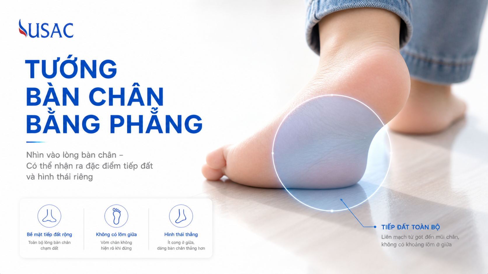 Tướng Bàn Chân Bằng Phẳng