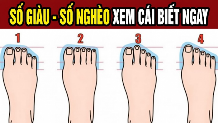 Tướng Lòng Bàn Chân Bằng Phẳng