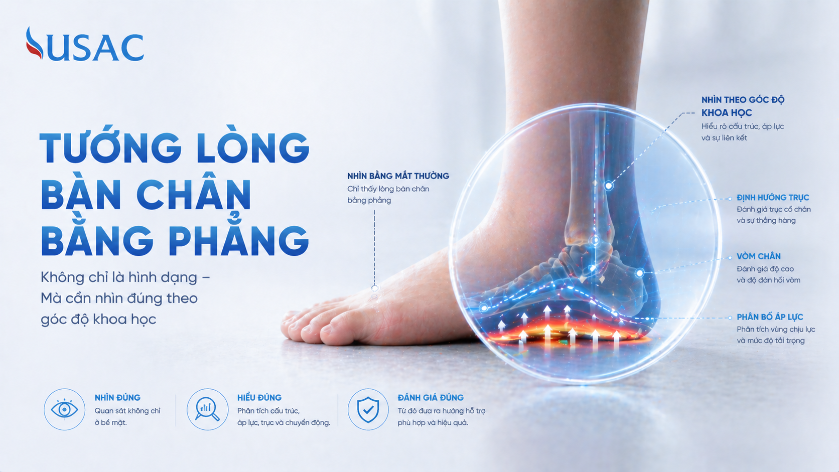 Tướng Lòng Bàn Chân Bằng Phẳng