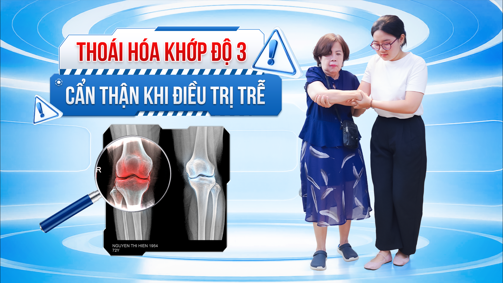 Xoa dịu cơn đau thoái hóa khớp gối độ 3 – 4 để mỗi bước đi là một niềm vui
